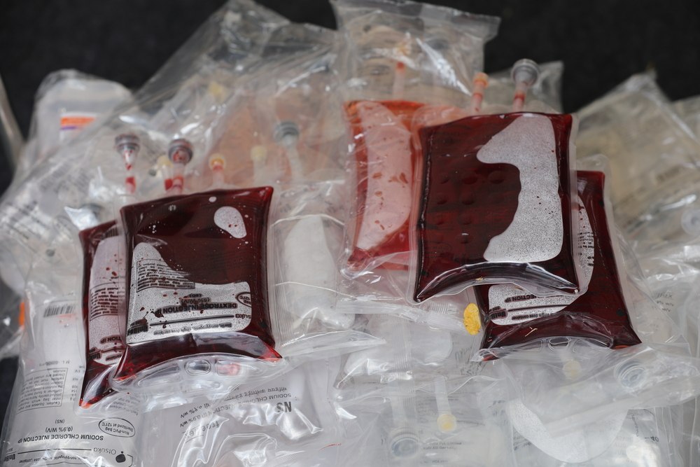 В Марий Эл необходимо восполнить запасы донорской крови