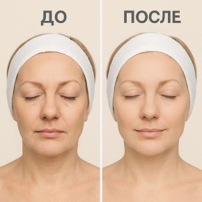 Как вернуть коже молодость: 5 продуктов, которые помогут ей сиять