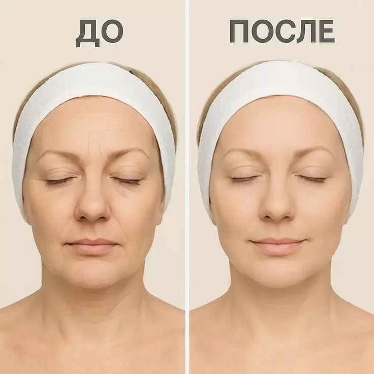 Как вернуть коже молодость: 5 продуктов, которые помогут ей сиять